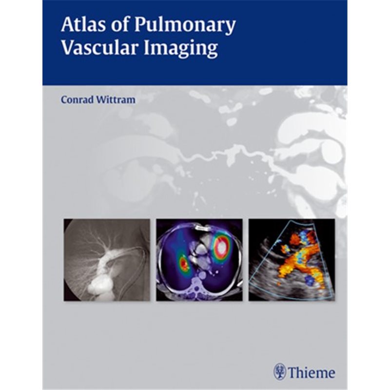 Atlas of Pulmonary Vascular Imaging - A Multimodality Approach